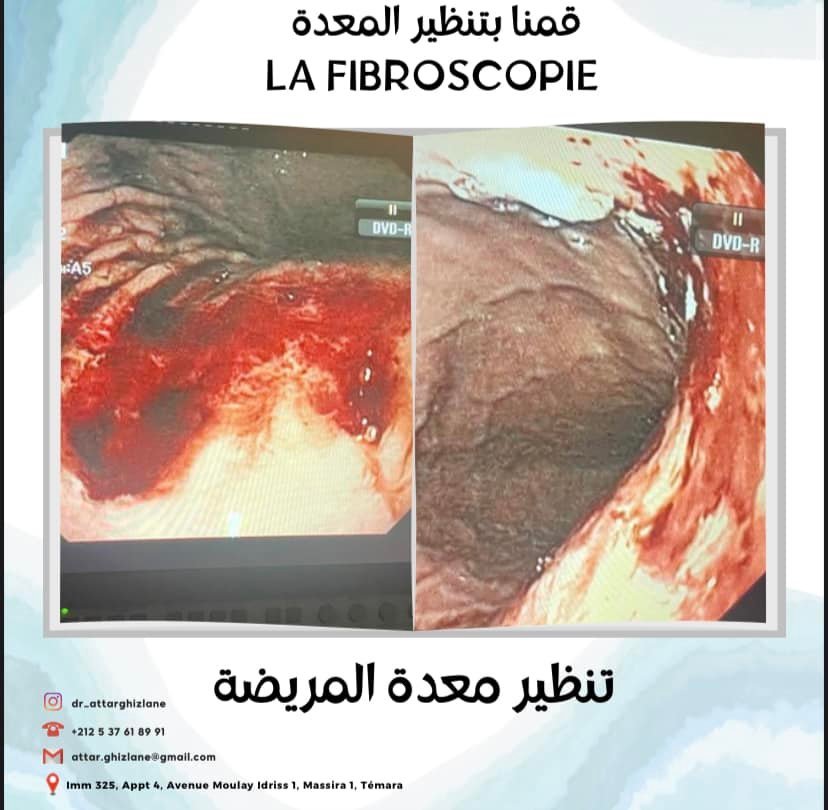 Photo 11 de Dr. Rhizlane ATTAR - GastroEntérologue