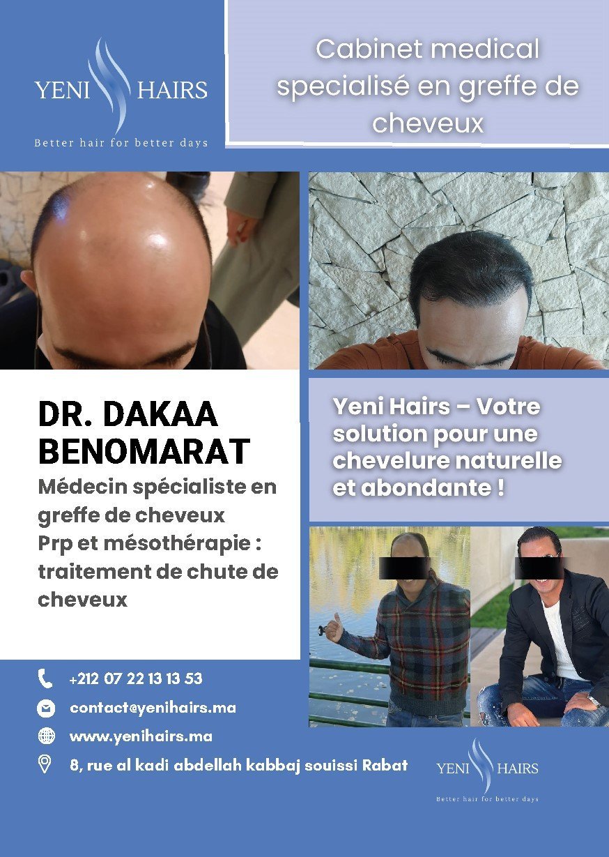 Photo 7 de YENI HAIRS - Greffe de cheveux Maroc